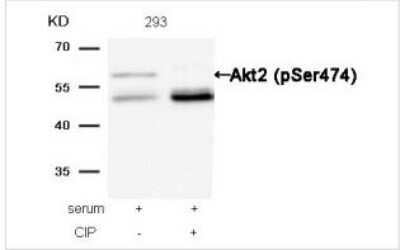 Western Blot: AKT2 [p Ser474] Antibody [NB100-81780] - Analysis of extracts from 293 cells, treated with serum or calf intestinal phosphatase (CIP), using Akt2 (Phospho-Ser474) Antibody.